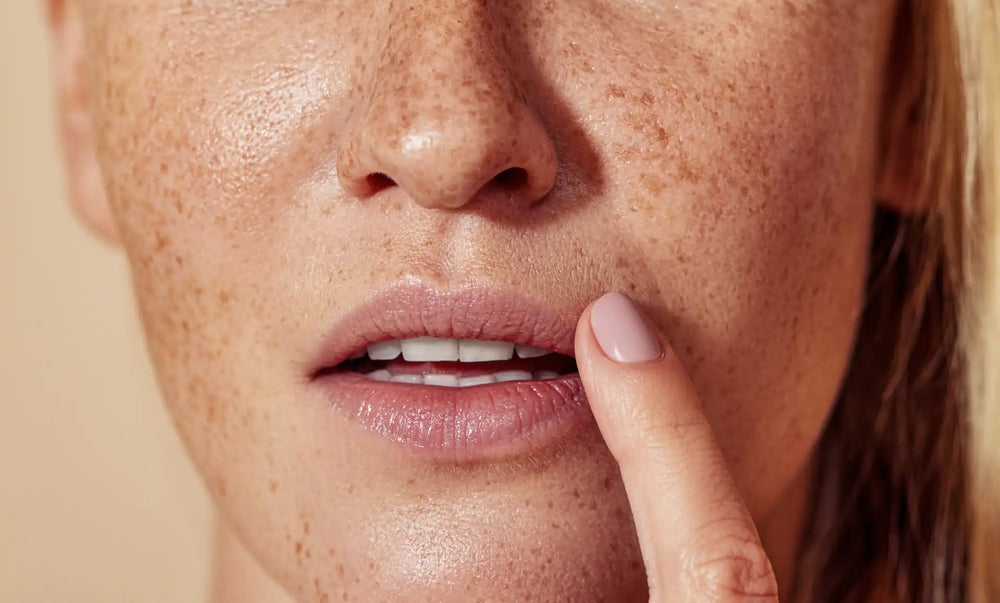 Como manter os lábios hidratados e macios? Mulher com sardas tocando o rosto, destacando cuidados com a pele e a beleza natural. A importância da autoestima e do autocuidado.