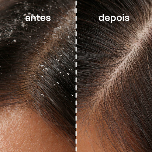 Shampoo Anticaspa em Barra