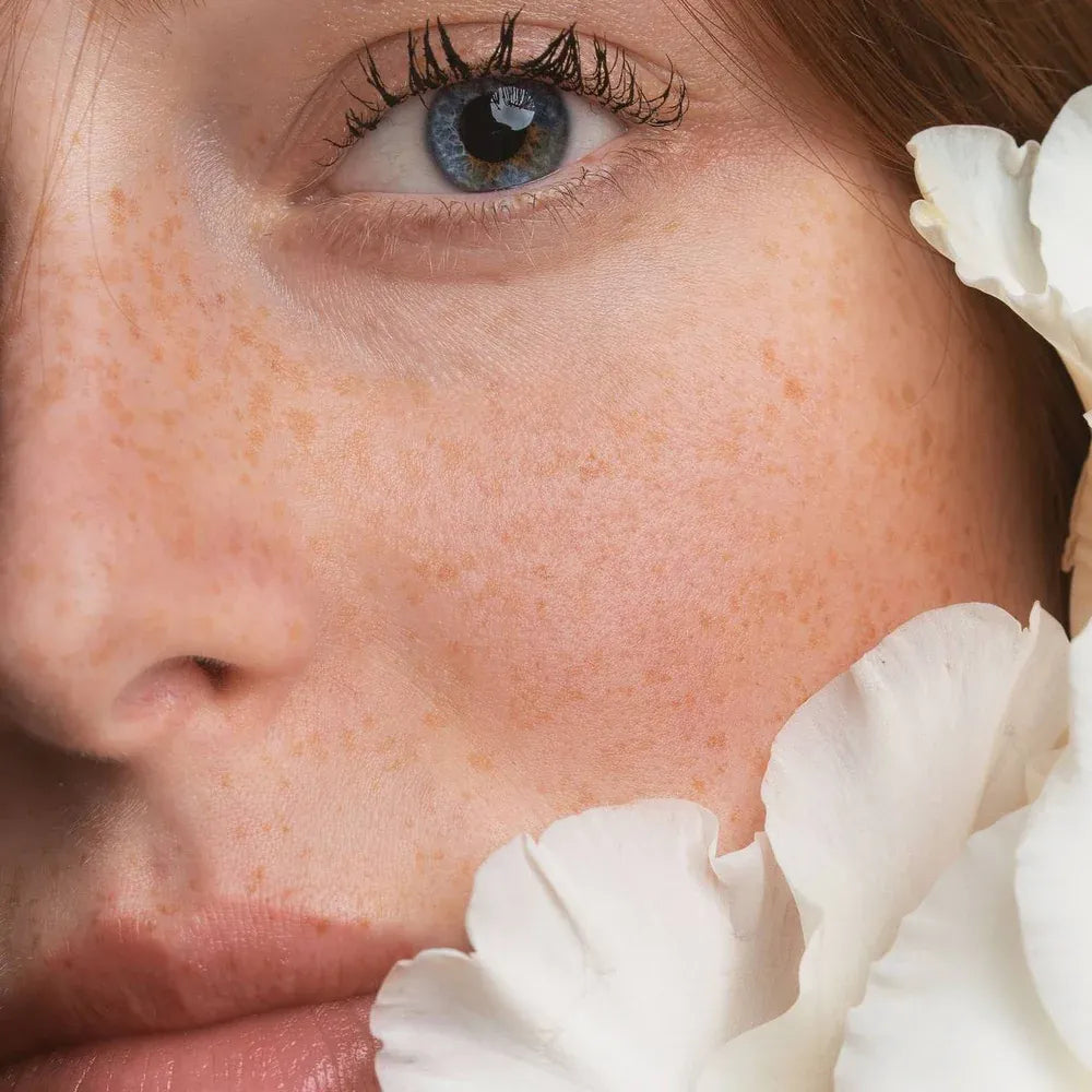 mulher com sardas e flores ao lado do rosto