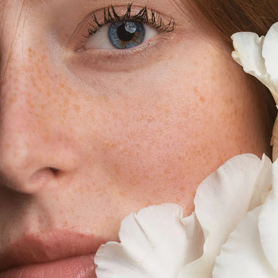 mulher com sardas e flores ao lado do rosto