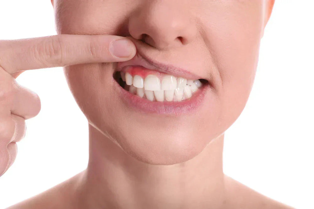 Mulher mostrando os dentes enquanto puxa o lábio para cima, destacando a saúde bucal e a importância da higiene oral.