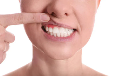 Mulher mostrando os dentes enquanto puxa o lábio para cima, destacando a saúde bucal e a importância da higiene oral.